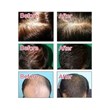 Dexe anti-hair loss shampoo